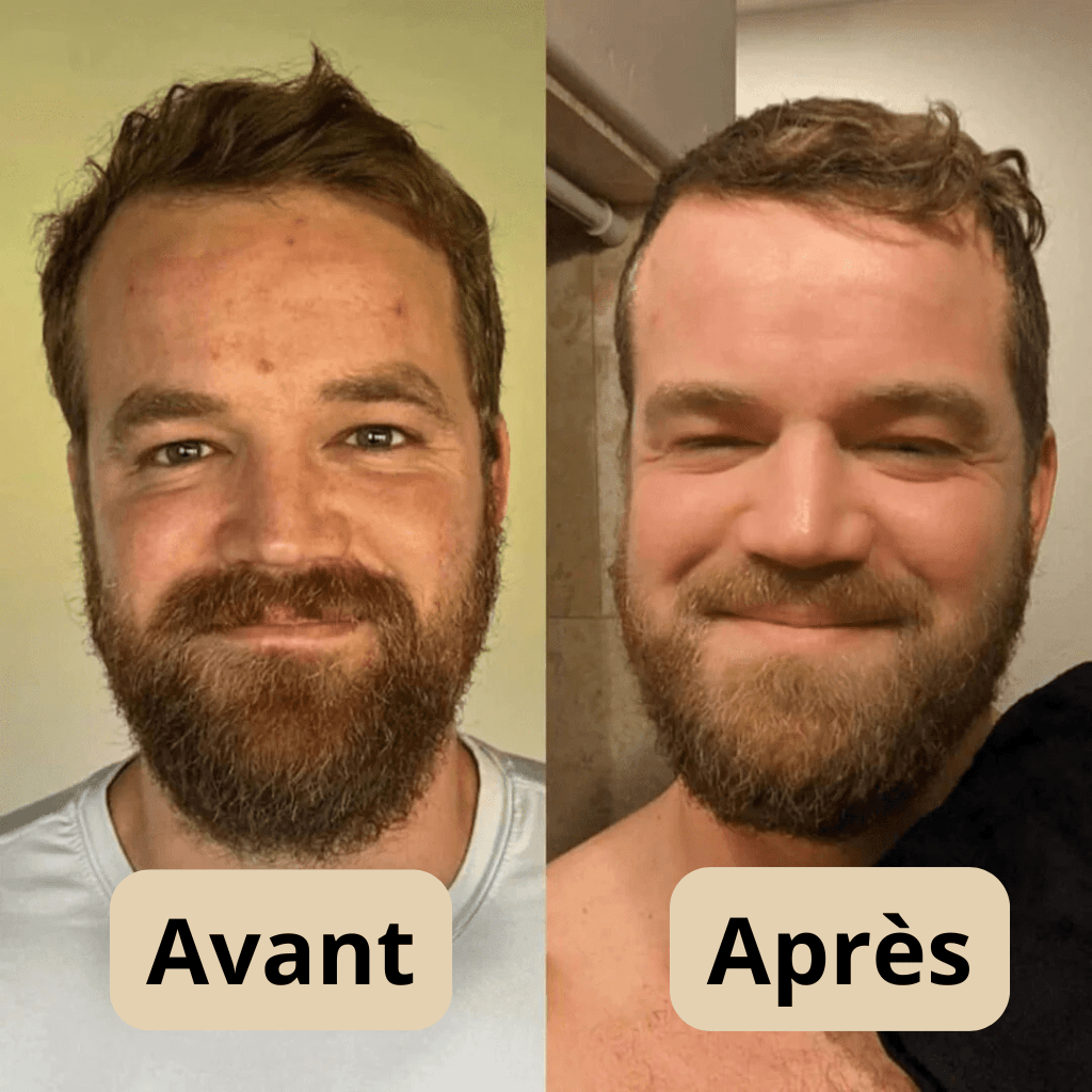 Peel Shot Coréen - Éliminé les Impuretés