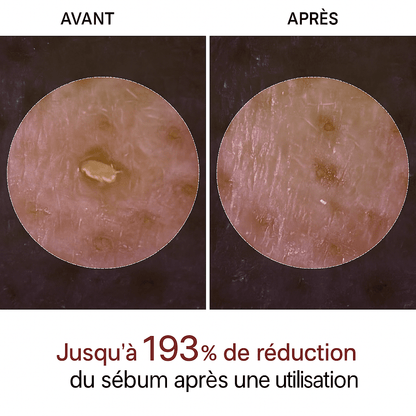 Peel Shot Coréen - Éliminé les Impuretés